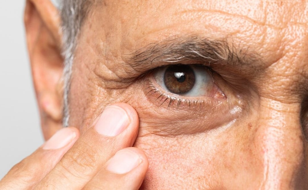 Los ojos disminuyen sus capacidades con el paso del tiempo. Foto: Freepik