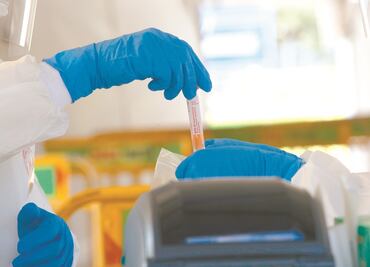 Expertos trabajan en nueva prueba para detectar el Covid-19 de forma rápida y económica