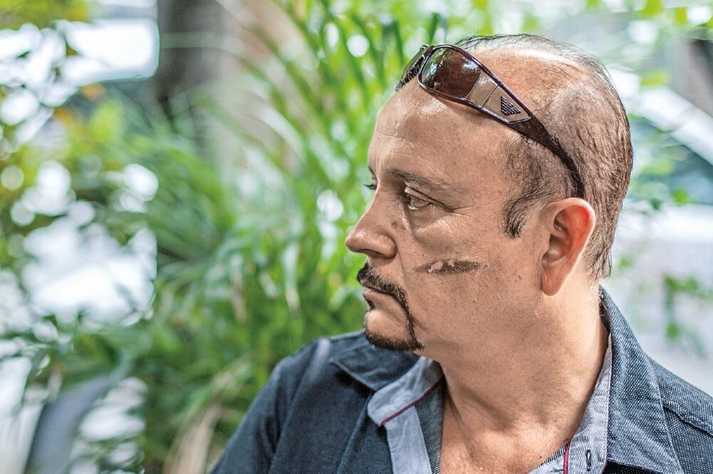 Carlos León, candidato de Movimiento Ciudadano a la alcaldía de Tlacolula de Matamoros, fue agredido a balazos mientras viajaba con su equipo (GERMÁN ESPINOSA. EL UNIVERSAL)