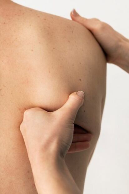 Qué significan los puntos rojos en la piel. Fuente: Freepik