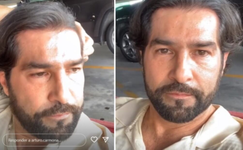 Padre de Arturo Carmona sufre aparatoso accidente, piden oraciones por su salud