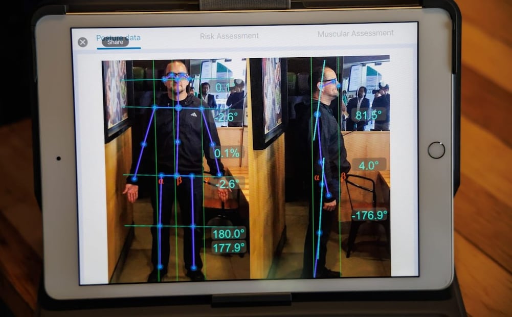 IA asiste en la rehabilitación. Imagen: cortesía