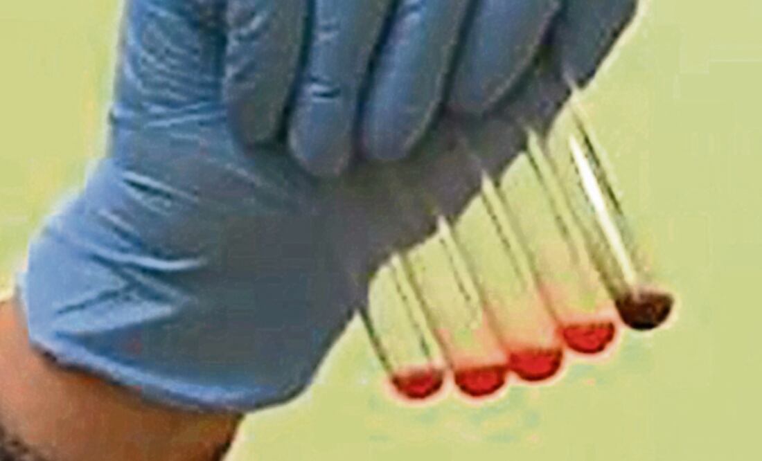 Criterios. La SCJN estableció que nadie puede ser obligado a someterse a la prueba de ADN, pero que ésta no viola la privacidad (ARCHIVO EL UNIVERSAL)