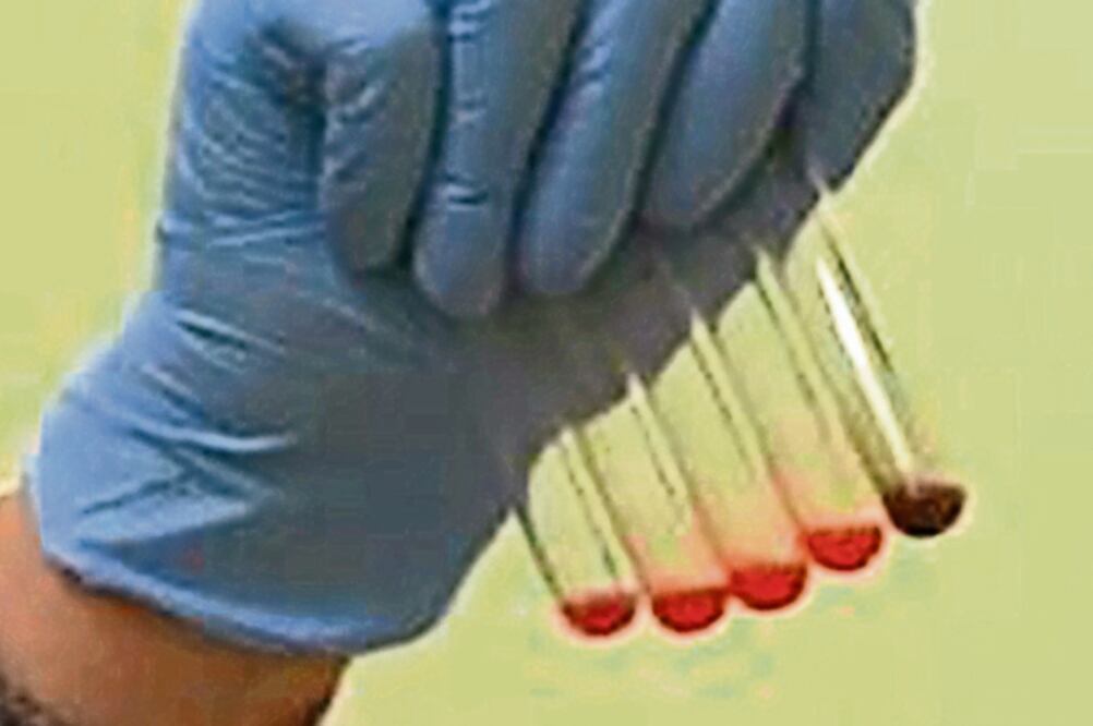 Criterios. La SCJN estableció que nadie puede ser obligado a someterse a la prueba de ADN, pero que ésta no viola la privacidad (ARCHIVO EL UNIVERSAL)