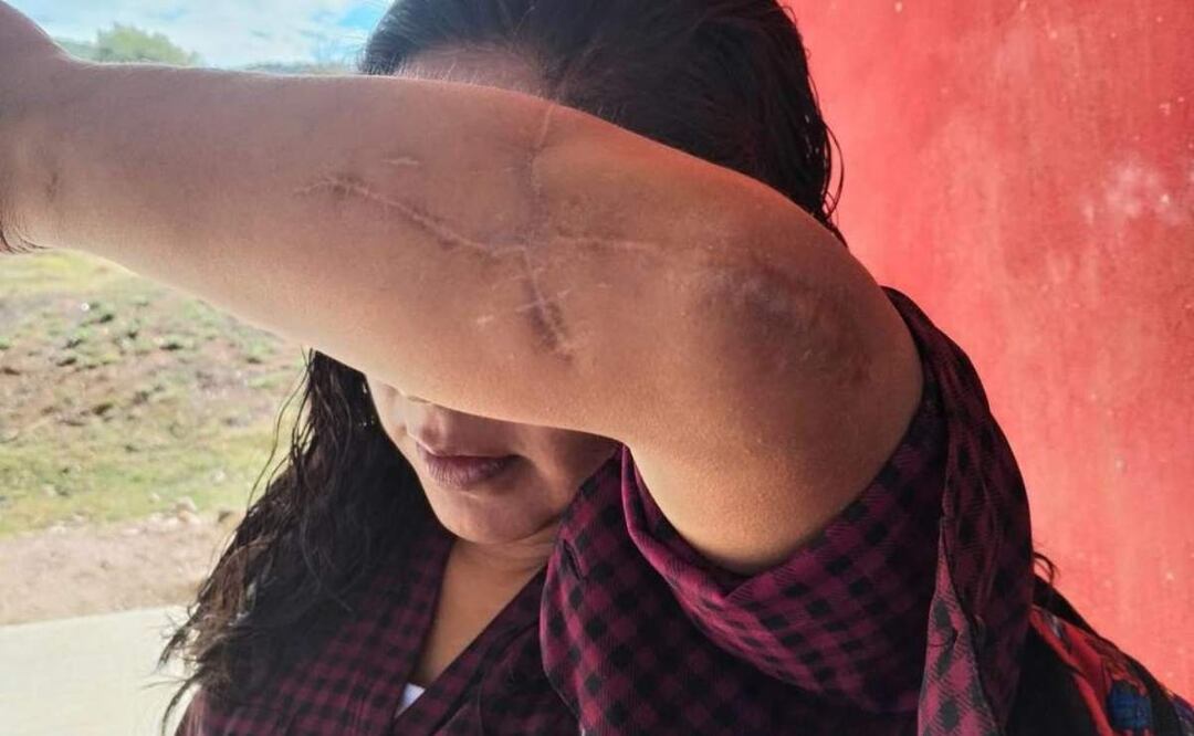 Guillermina López Jiménez, víctima de tentativa de feminicidio por su expareja en Oaxaca (21/03/2025). Foto: Especial