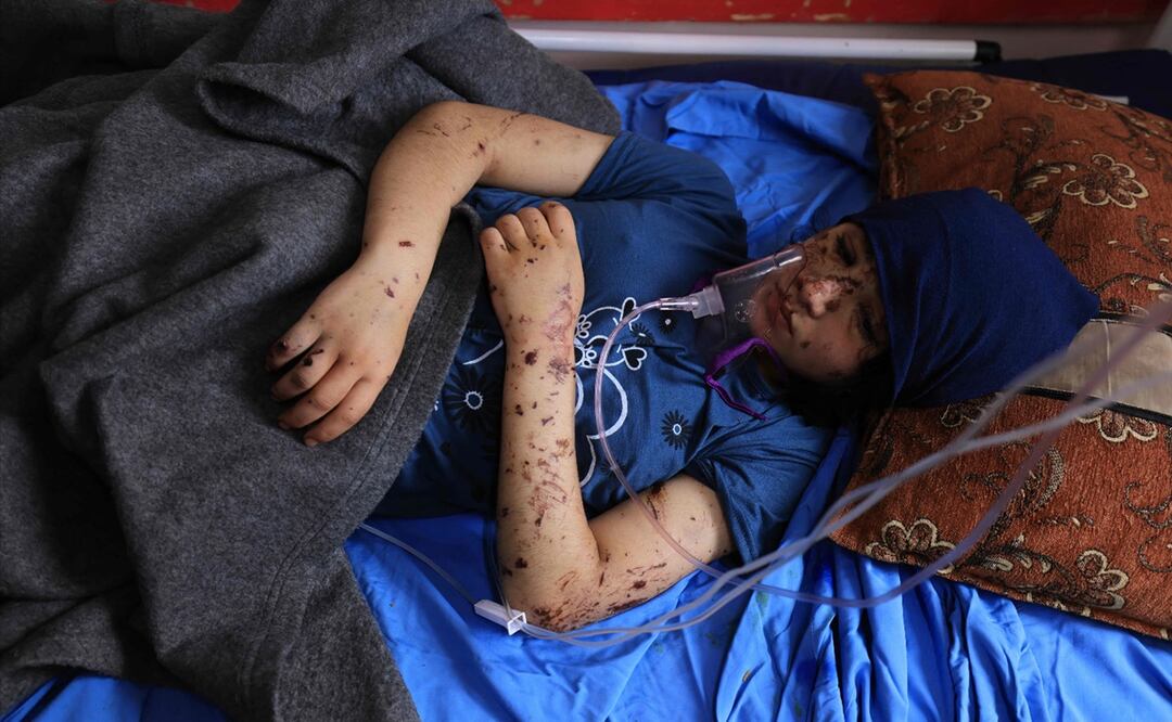 Layan resultó débilmente herido en un ataque en el distrito de Al-Qarara, como parte de la campaña militar de Israel en respuesta a los sangrientos ataques de Hamas. Foto: AFP