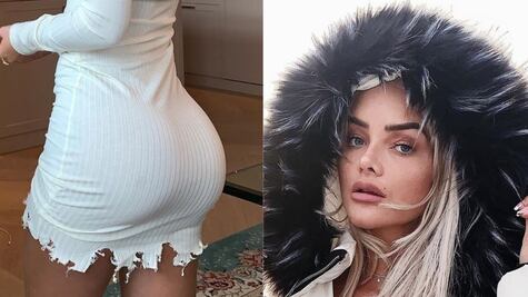 Sophie Elise busca quitarse los implantes que se puso en los glúteos