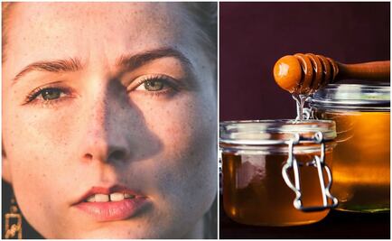 Despídete de las manchas por el sol con estas recetas caseras