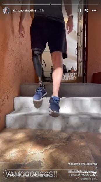 Así se esfuerza Juan Pablo Medina para dominar la prótesis de su pierna