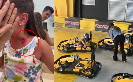 Papá de niña de 6 años herida en "Kartzone", Coyoacán denuncia negligencia: "no tienen supervisión adecuada"