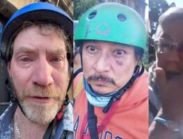 Marcha de la Generación Z deja periodistas lesionados; denuncian agresiones policiacas