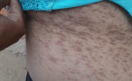 Detectan arsénico en sangre de pobladores de Sonora