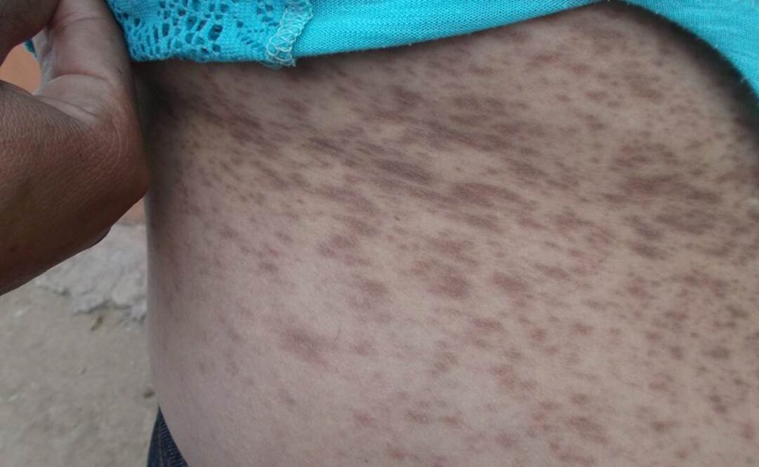 Foto: Amalia Escobar / EL UNIVERSAL