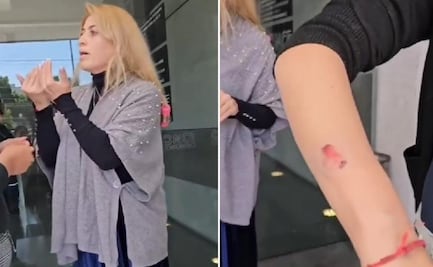 "Lady mordidas": Mujer ataca con mordiscos a manicurista para no pagarle arreglo de uñas en Edomex