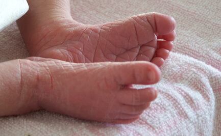 Día Internacional de la piel de mariposa: ¿cómo viven las personas con este padecimiento?