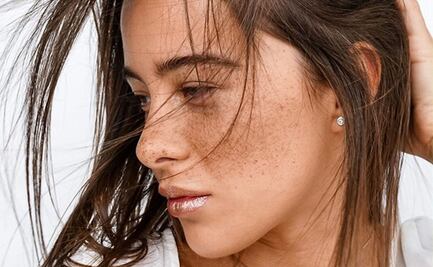 ¿En qué consiste la micropigmentación de pecas?