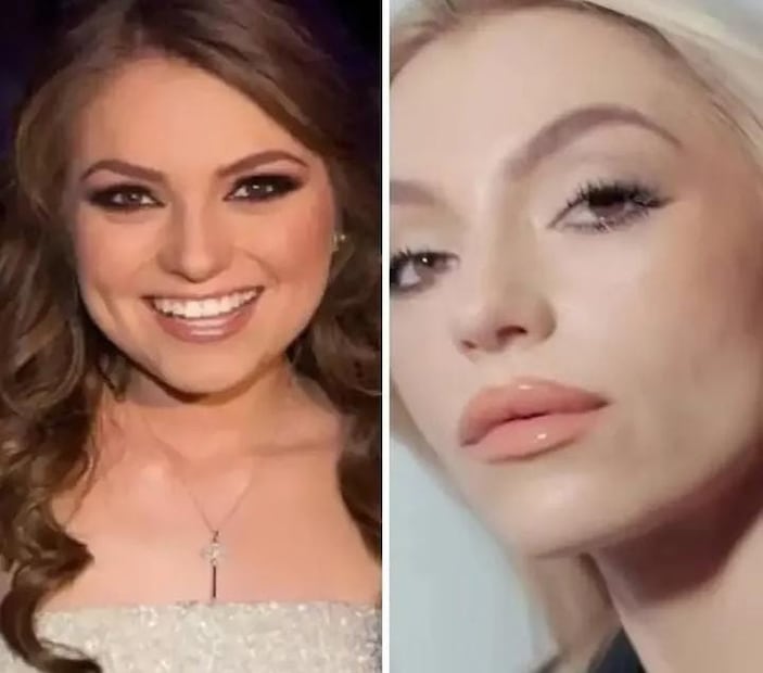 Cuestionan en redes el rostro de Sofía Castro de antes y el de ahora. Ella niega cirugía estética.