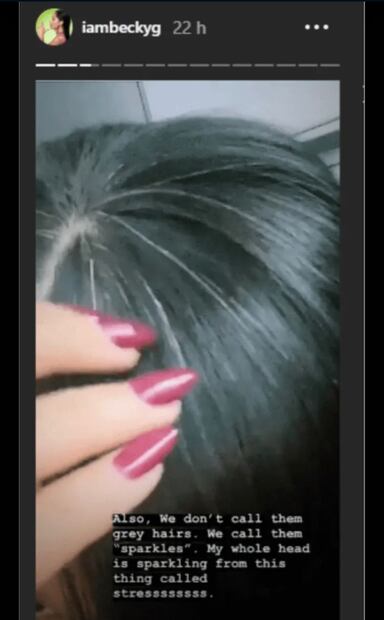 La cantante de 25 muestra orgullosa su cabellera con canas. Foto: Instagram.