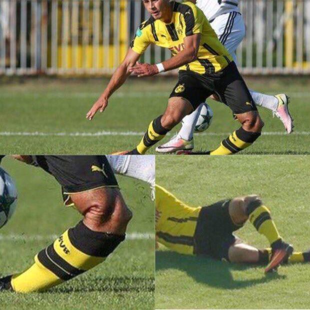 Promesa del Dortmund que sufrió alarmante lesión, se retira a los 21 años