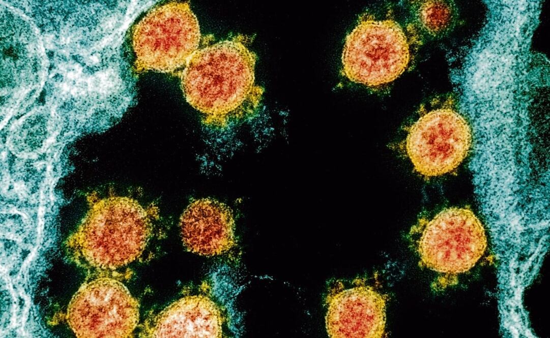 Hoy en día es importante conocer cuáles son los síntomas del coronavirus, cómo prevenirlo y cómo detener su propagación - Foto: National Institute of Allergy and Infectious Diseases