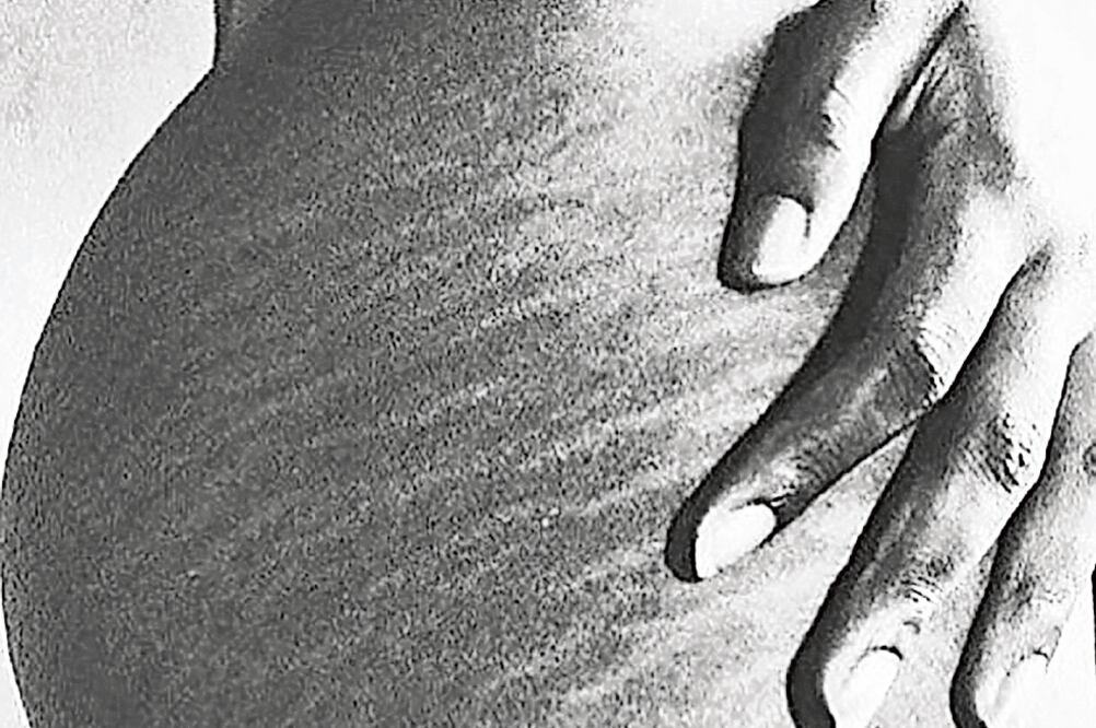 uera máscaras. Hace unos días publicó una imagen de ella sin maquillaje, y ahora lo hizo de su cadera. Además de la campaña, la intérprete ha levantado la voz por los refugiados, lanzando el cortometraje “Let Me In” (Instagram)