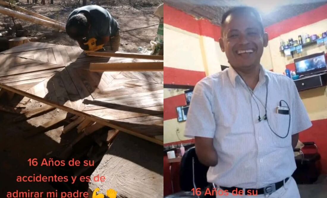 Hace aproximadamente 16 años tuvo un accidente en el cual está hombre perdió sus brazos. Foto: Captura de video