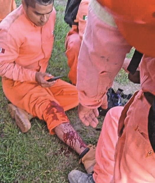 Cuatro trabajadores de Dos Bocas, heridos por policía