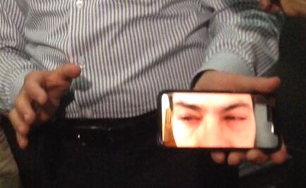 Rayos UV de lámparas causaron irritación en los ojos a Peña Nieto: Narro