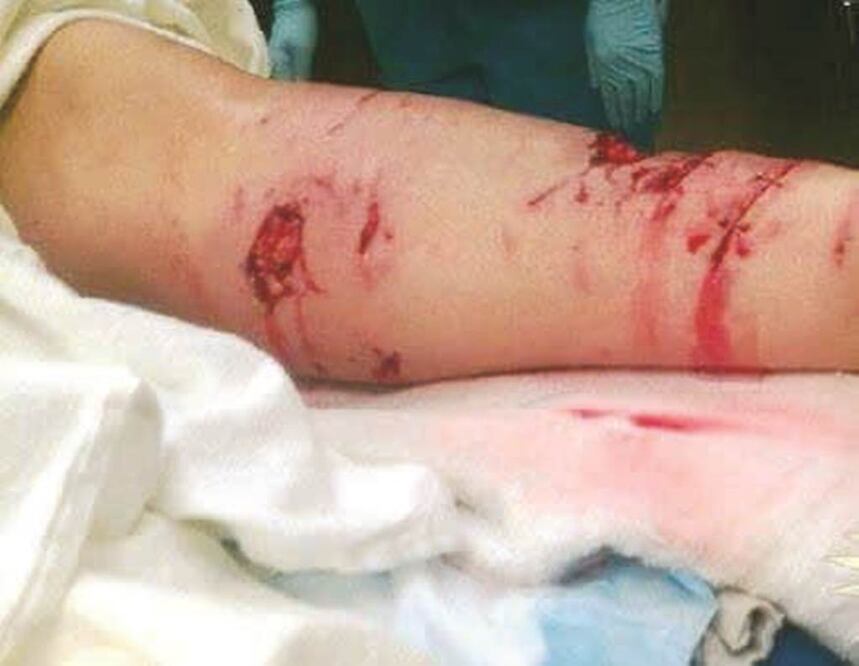 Según la Cruz Roja, en este año han muerto dos personas por ataque de perros en el municipio y se han incrementado 100% las lesiones por mordeduras. (ESPECIAL)