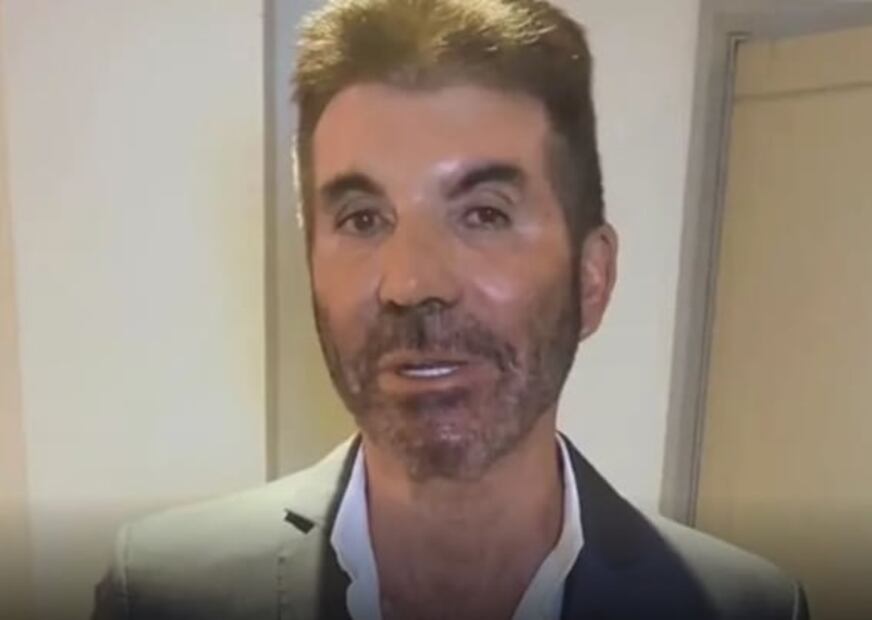 Lanzan críticas a Simon Cowell, juez de "American Idol", tras aparecer con un cambio radical en el rostro 
