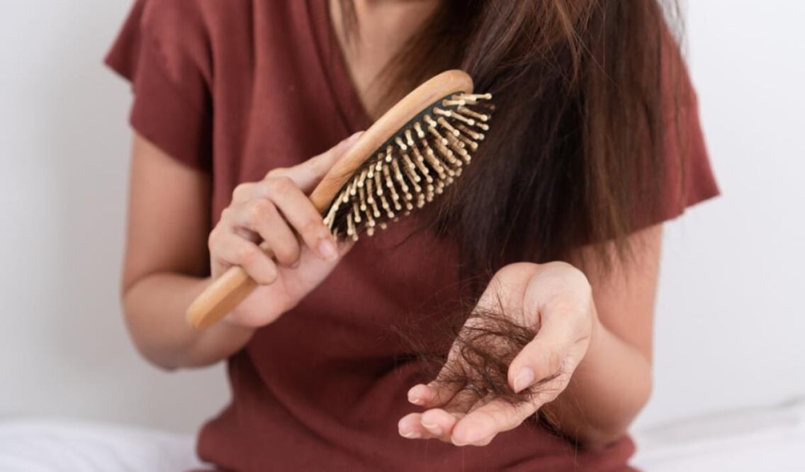 Toma nota para que ya no sufras la caída de tu pelo / Foto: Uniplash 