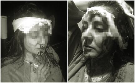 No la golpeé con un bate, ella me atacó con un cuchillo: exesposo de Abril prófugo