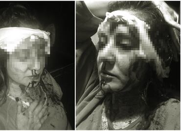 No la golpeé con un bate, ella me atacó con un cuchillo: exesposo de Abril prófugo