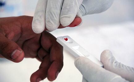 "Seguimos sin vacuna de VIH pero ahora conocemos su talón de Aquiles"