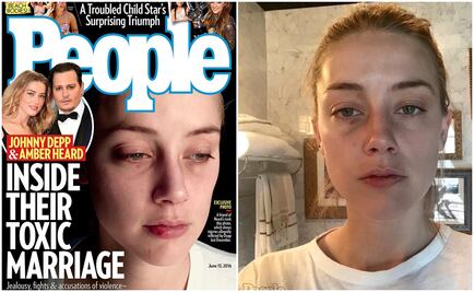 Amber difunde más fotos de agresiones de Johnny Depp 