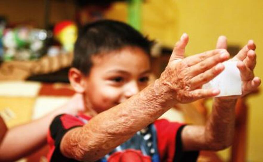 Su motivación es ir al campamento