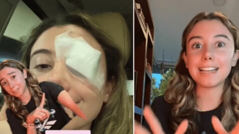 Joven termina en el quirófano luego de probar un truco de belleza en TikTok