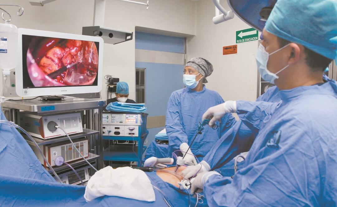 De los trasplantes realizados a nivel nacional destacan 18 de hígado, 253 renales, 192 de córneas y 71 de médula ósea, detalló el instituto. Foto: Twitter del IMSS