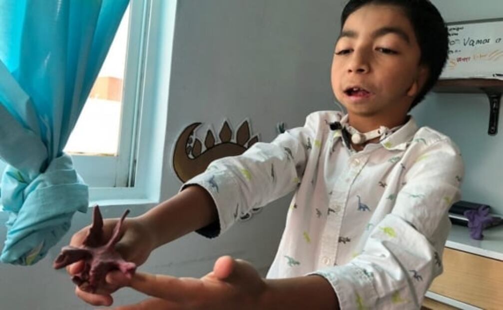 “Santisaurio” tiene 9 años y lo han operado 15 veces; sueña con ser influencer mexiquense