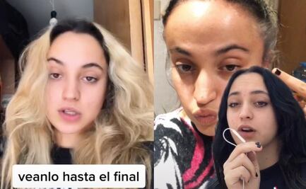 Mujer se pinta el pelo y le causa alergia: mira lo que pasó