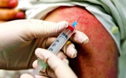 Sarampión, el virus que es más contagioso que el Covid-19