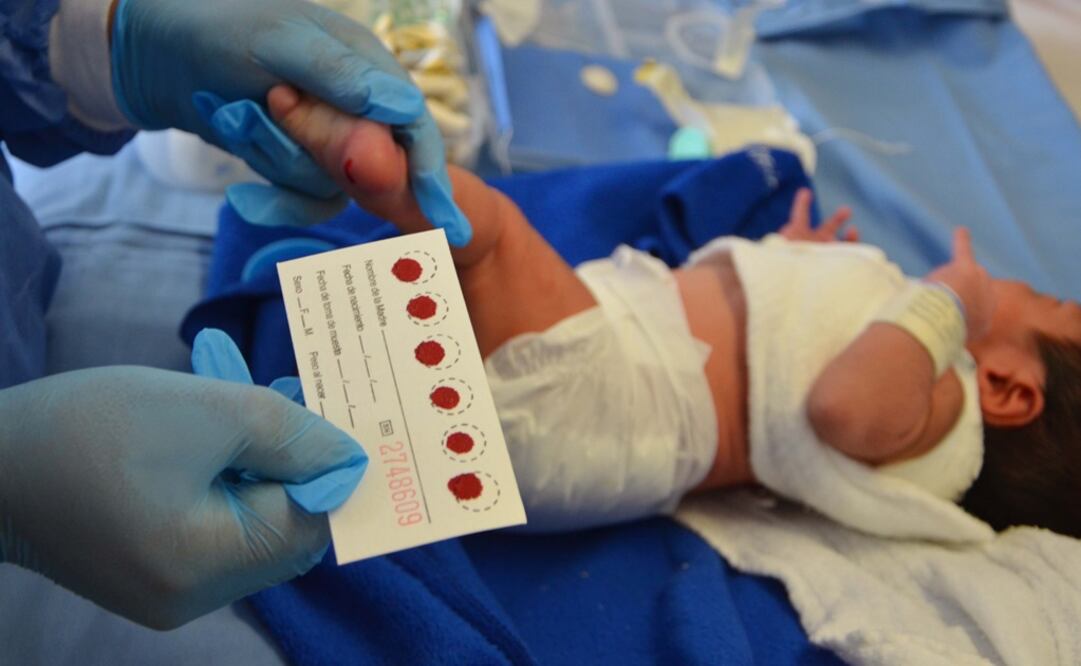 El tamiz neonatal ayuda a la detección temprana de enfermedades/ Foto: Secretaría de Salud 