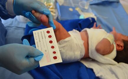 ¿Qué es el tamiz neonatal? ¿Para qué sirve?