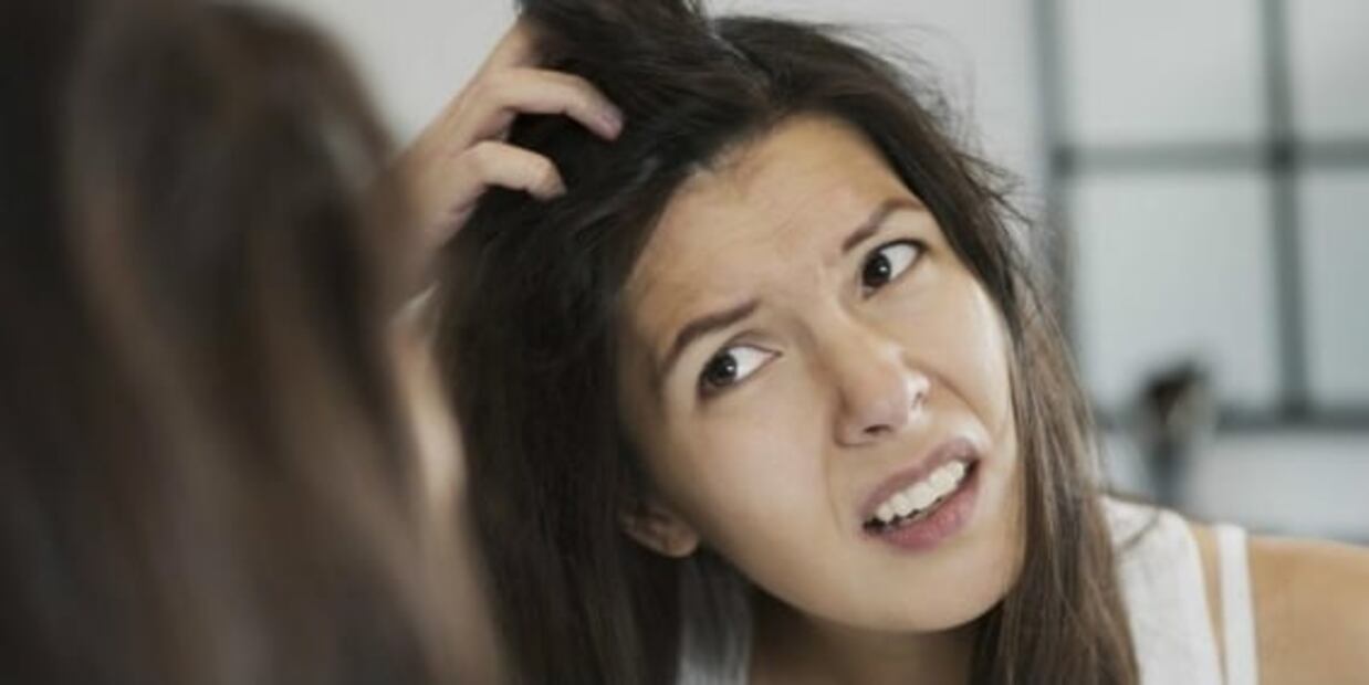 Remedios naturales contra la caspa que debes conocer 