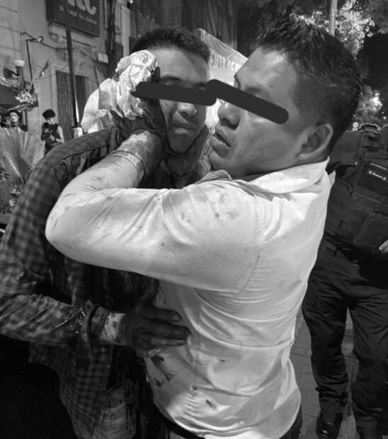 Riña en bar Cabaretito en Zona Rosa deja a un hombre con cortaduras en el rostro