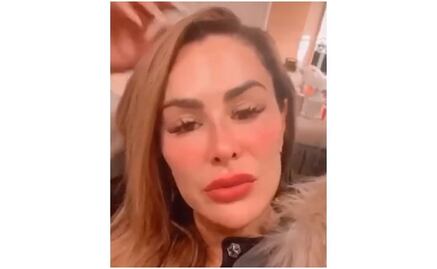 Llama la atención rostro de Ninel Conde, "era bonita", dicen cibernautas