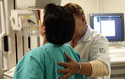 Identifican primer 'atlas' de proteínas para pronosticar el cáncer de mama