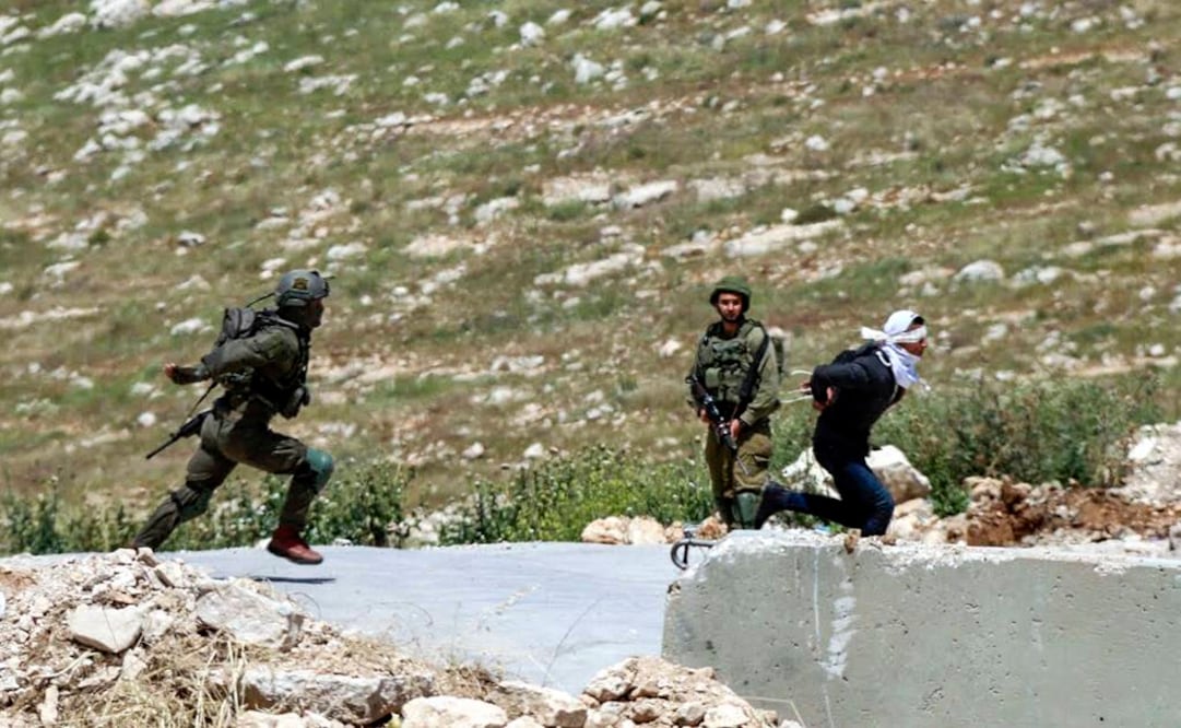 Las fuerzas israelíes no volvieron a detener al menor tras ser llevado al hospital, indicó el periódico israelí "Yediot Ahronot" (Foto: AFP)