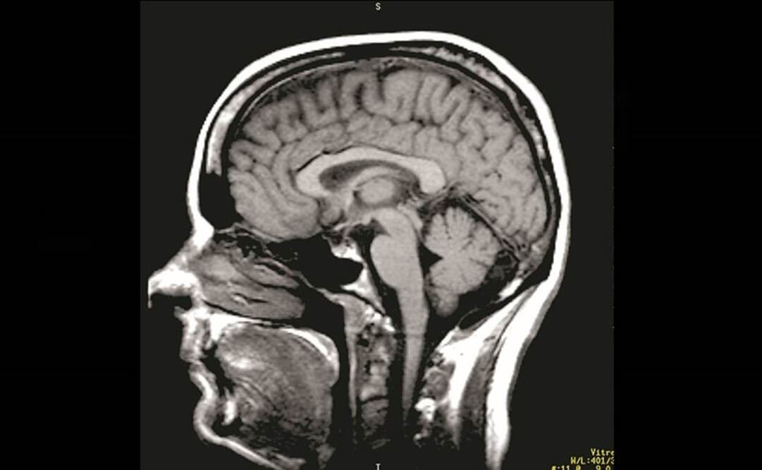 Creencias populares como que usamos sólo un porcentaje ínfimo del verdadero potencial cerebral "son falsas". Foto: Archivo