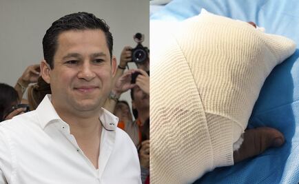 Gobernador de Guanajuato se fractura tres dedos tras conducir en motocicleta